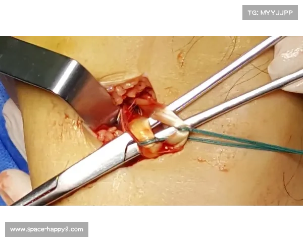 莱比锡官宣韦德拉奥果左膝腘绳肌肌腱受伤，将缺阵数周